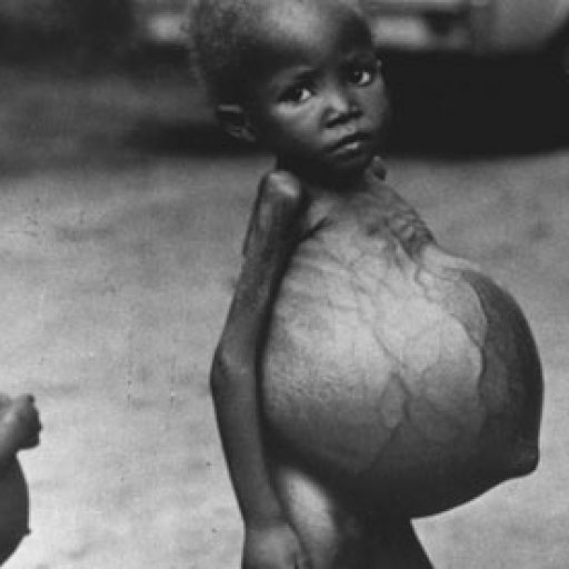 Biafran-CHILDREN-STARVING-008