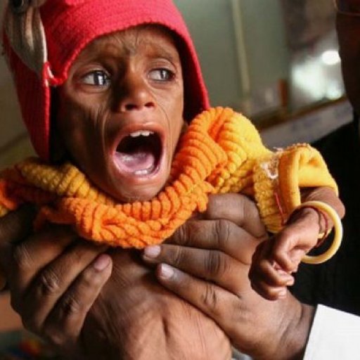 india-starving-baby