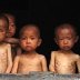 NORTH KOREA STARVING CHILDREN northkoreafamine