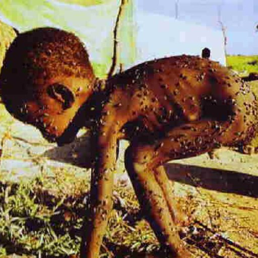 Starvingchildinflies-Africa