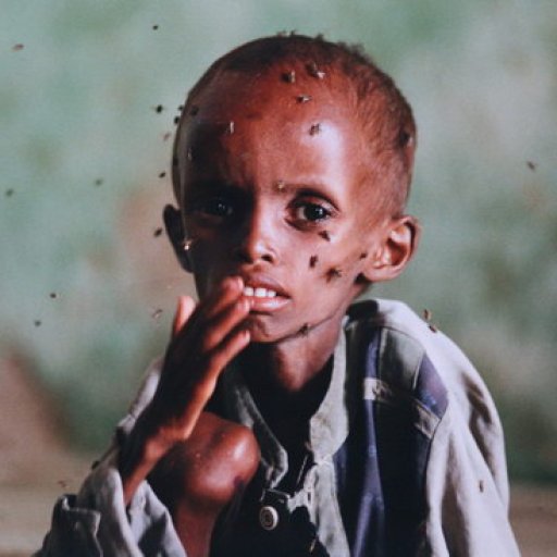 starving-child-in-mogadishu