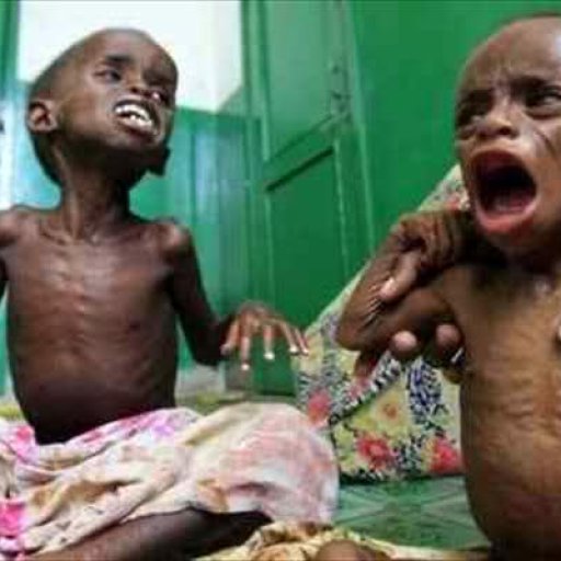 starving-children-in-somalia