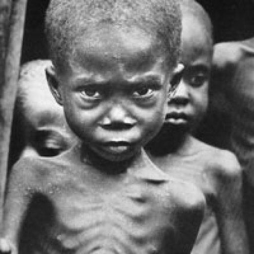 Starving-in-Biafra