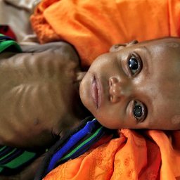 03a-somalia-famine.jpg
