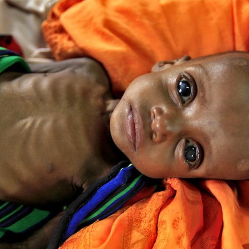 03a-somalia-famine