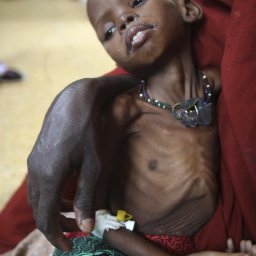 132838-millions-of-malnourished-children-in-horn-of-africa-are-at-risk-of-dyi.jpg