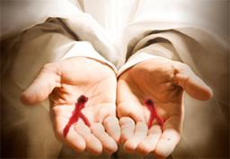 Lord Yours is the Wound